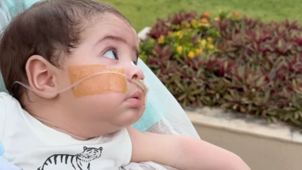 baby bronchiolitis obliterans